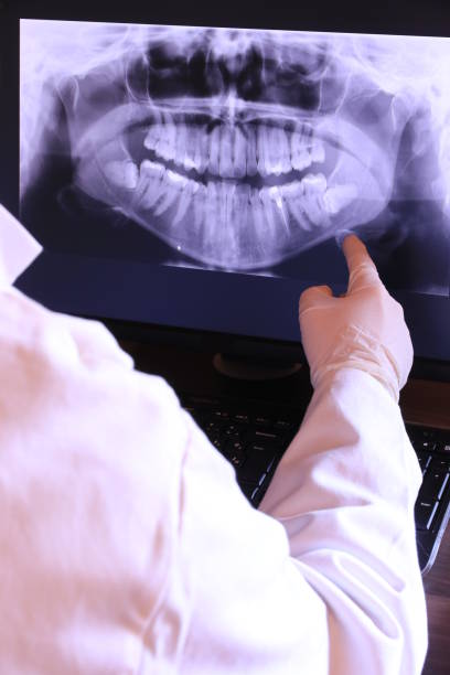 Best Emergency Wisdom Tooth Extraction in Judsonia, AR