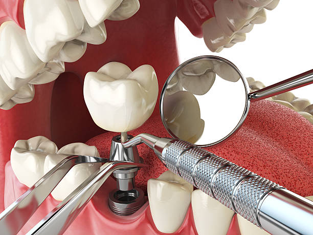 Best Emergency Wisdom Tooth Extraction in Judsonia, AR